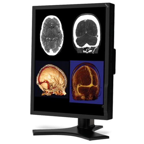 NEC MD212MC 2MP Color Diagnostic Monitor