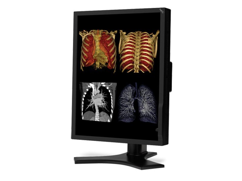 NEC MD213MC 3MP Diagnostic Radiology Monitor