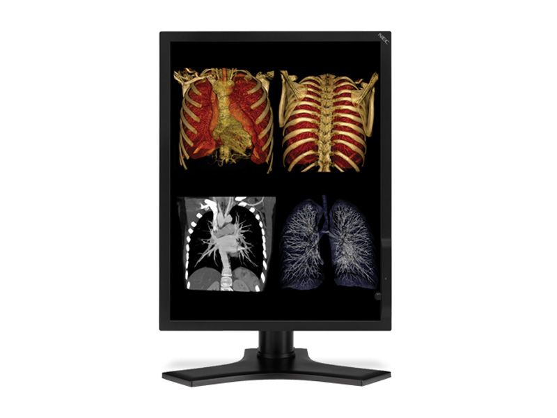 NEC MD213MC 3MP Diagnostic Radiology Monitor