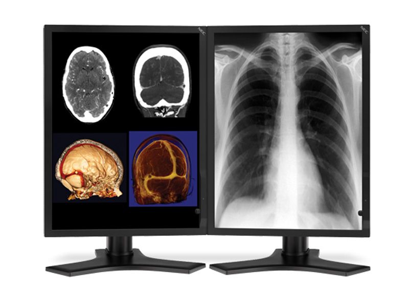 NEC MD213MC 3MP Diagnostic Radiology Monitor