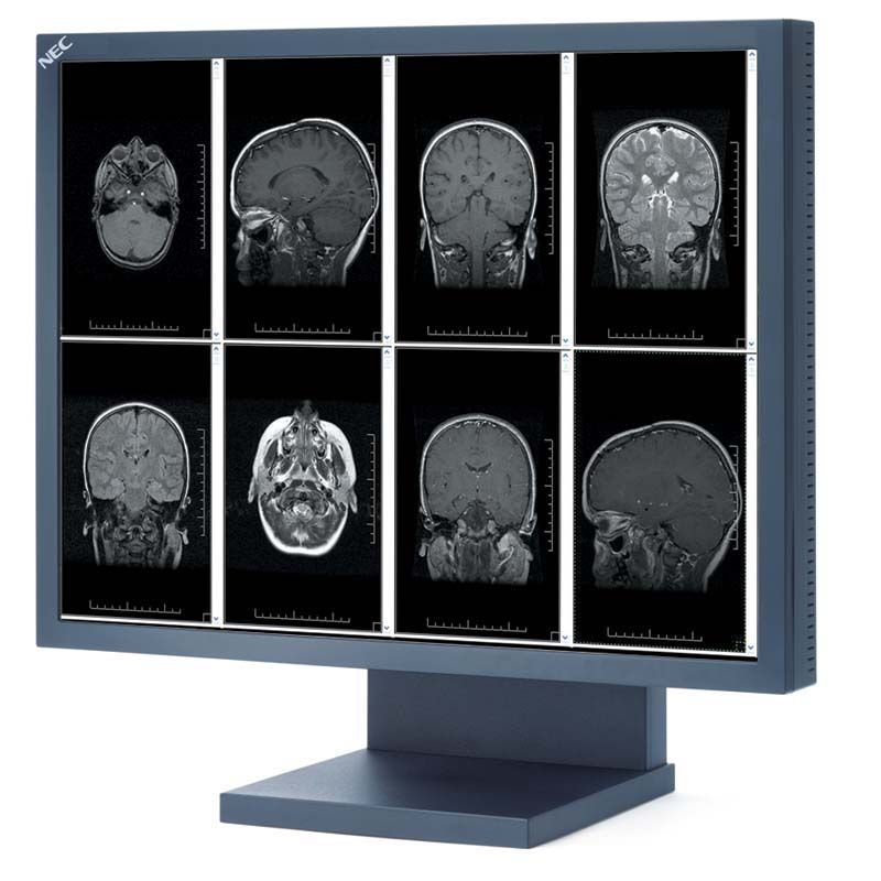 NEC MD21GS3MPBKBB 21-inch 3MP Medical Monitor