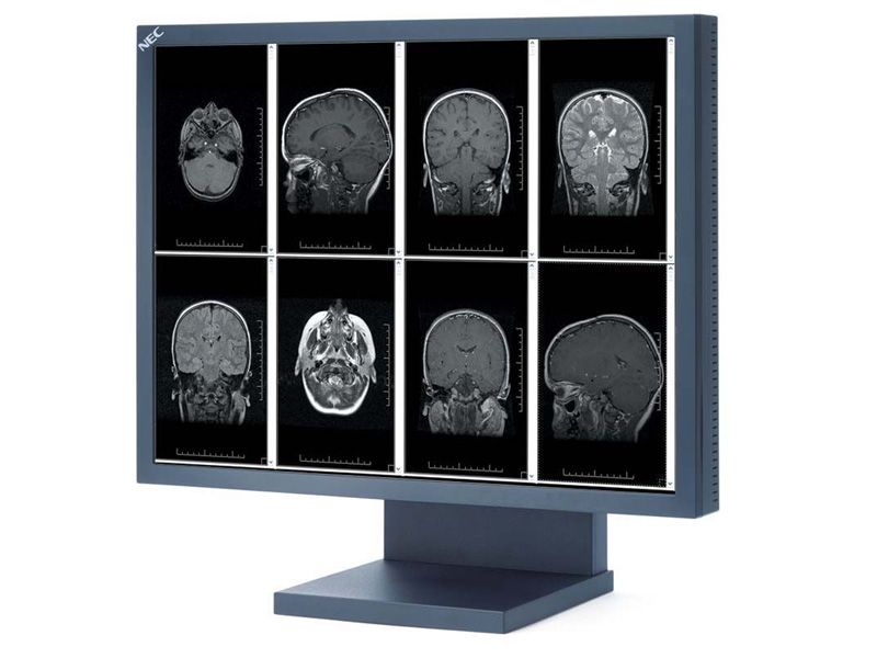NEC MD21GS-2MP-BK-CB 2MP Medical Monitor