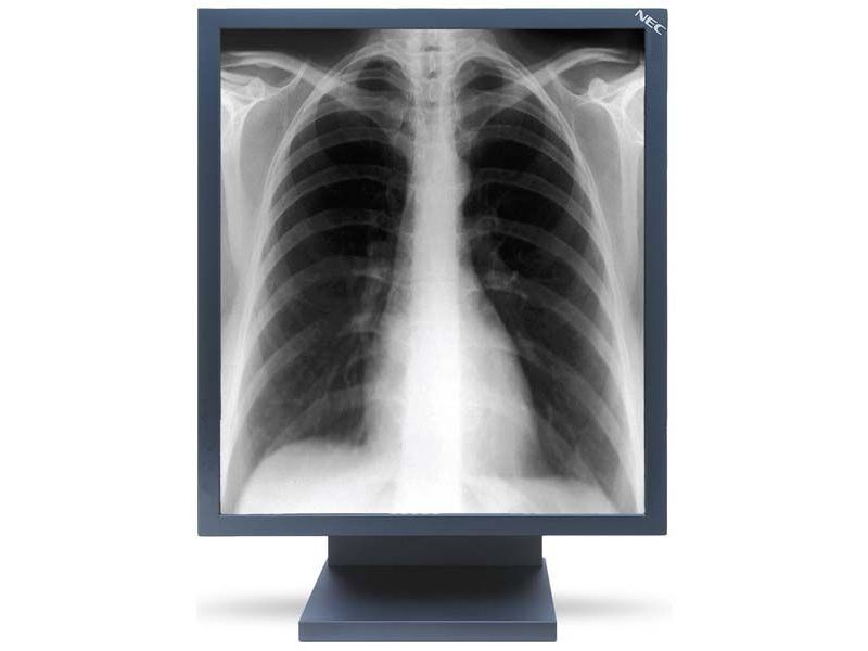 NEC MD21GS-2MP-BK-CB2 2MP Diagnostic Radiology Monitor