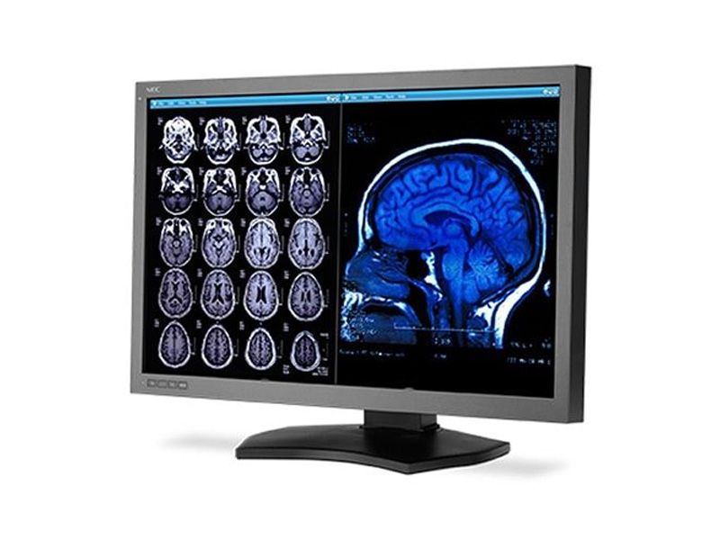NEC MD302C6 6MP Diagnostic Radiology Monitor