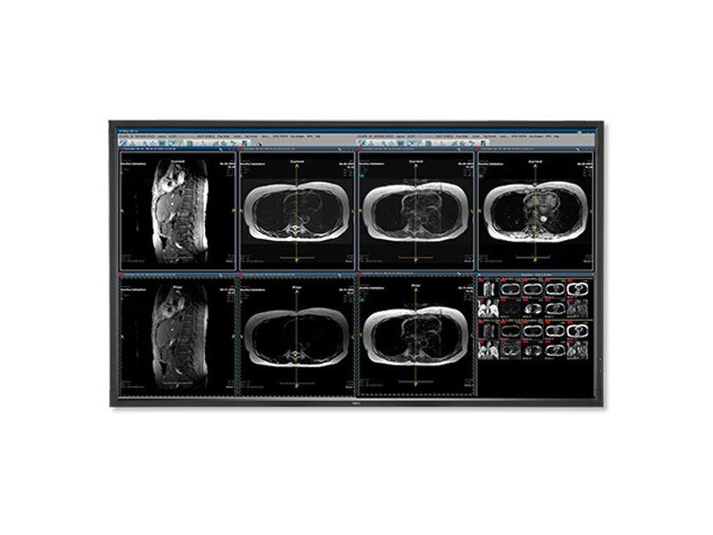 NEC MDC551C8 55" 8MP Medical Clinical Display