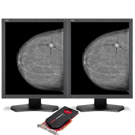 NEC MDG5-BNDL2 Grayscale 5MP Bundle with AMD Video Card