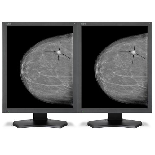 NEC MDG5-BNDL2 Grayscale 5MP Bundle with AMD Video Card