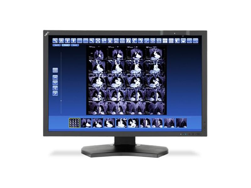 NEC MD302C4 4MP Diagnostic Radiology Monitor