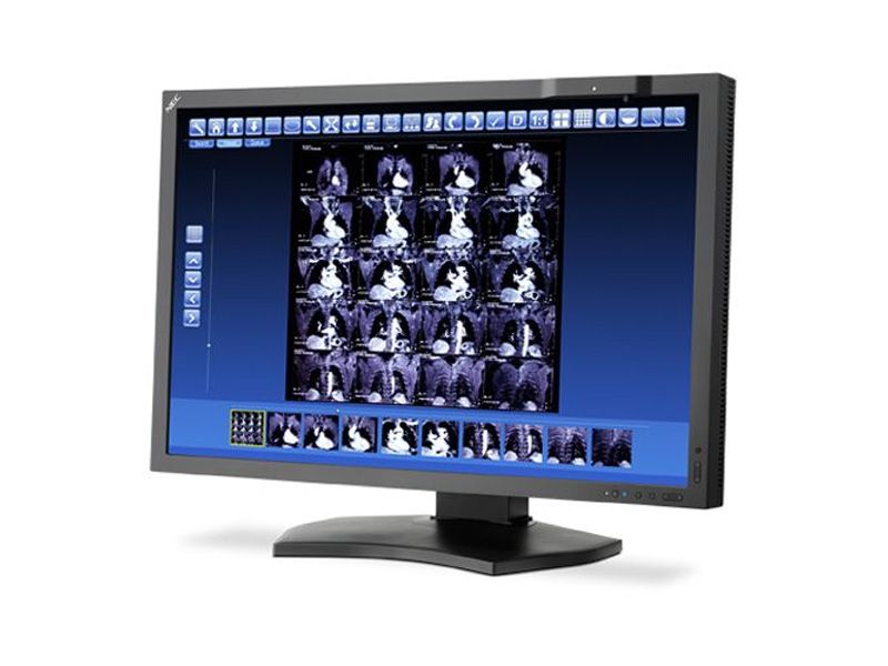 NEC MD302C4 4MP Diagnostic Radiology Monitor