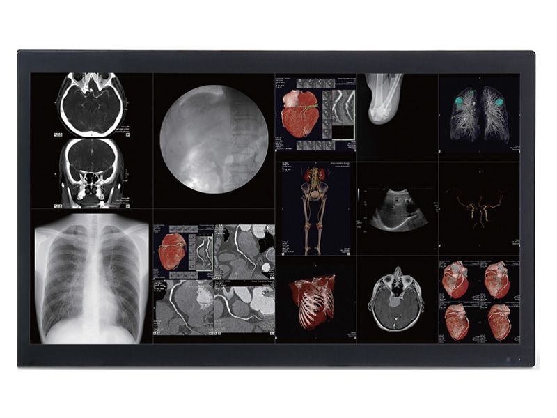Optik View DC4081X 8MP Medical Display