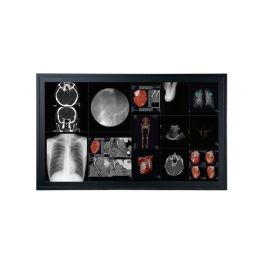 Optik View DC5801 58" 4K UHD Large Cath Lab Surgical LCD Monitor