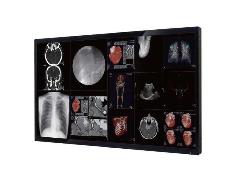Optik View DC5821 58" 4K UHD Large Cath Lab Surgical LCD Monitor