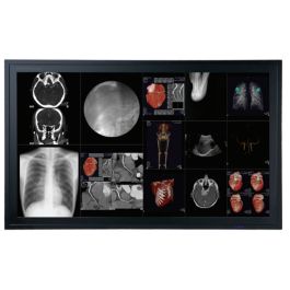 Optik View DC 802 8MP QFHD Medical Display