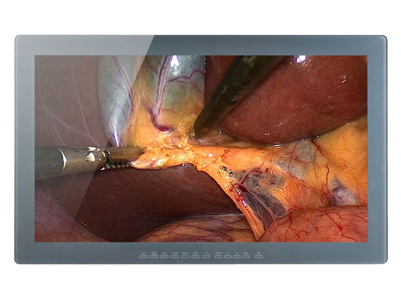 Optik View SC2413 24" WUXGA Surgical LCD Monitor