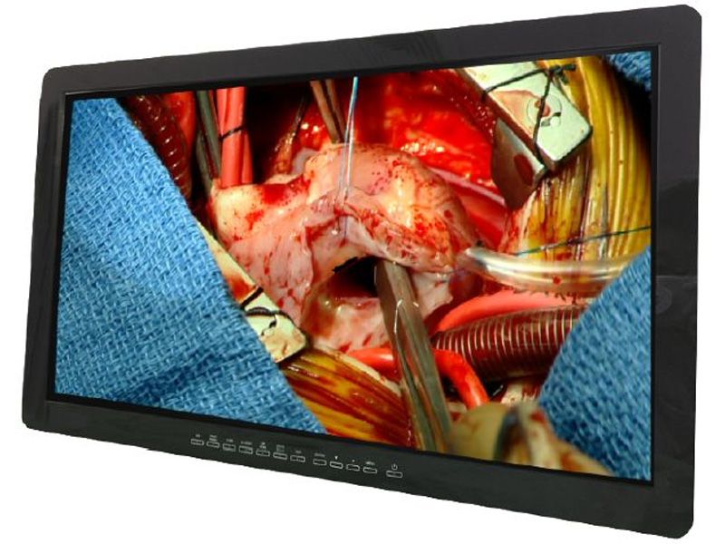 Optik View SC27210 27" FHD Surgical Monitor