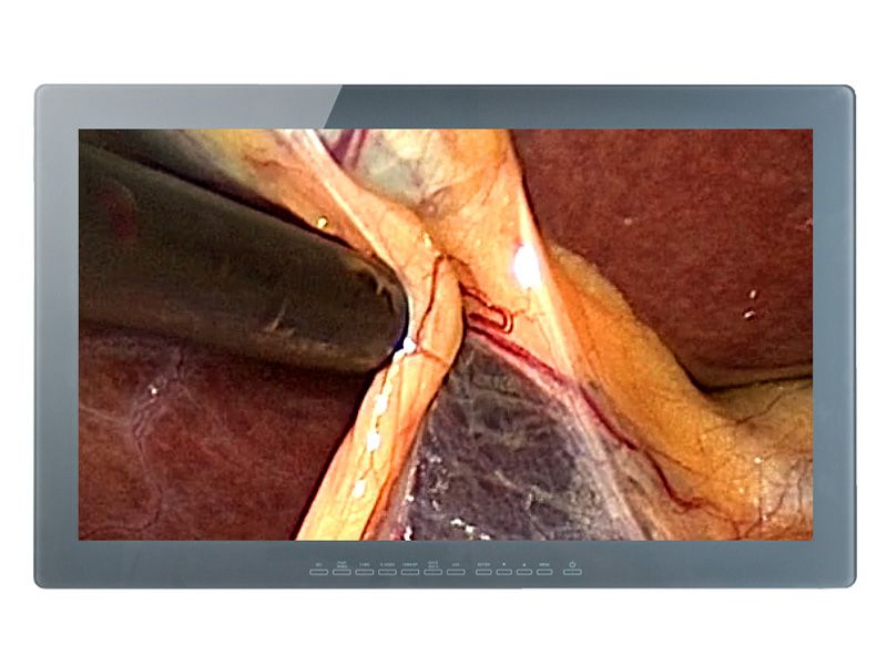 Optik View SC31813 31.5" 4K UHD Medical Grade LCD Monitor