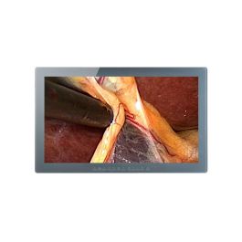 Optik View SC31810 31.5" 4K UHD Surgical LCD Monitor