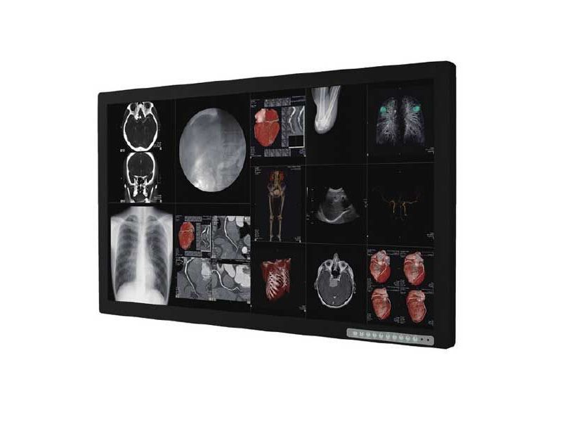 Optik View SC55820 55" 4K UHD Surgical LCD Monitor