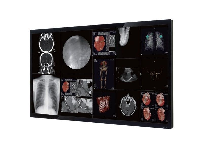 Optik View SC65812 65" 4K UHD Surgical LCD Monitor