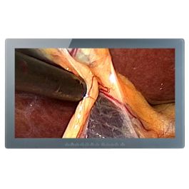 Optik View SC3181x 31.5" 4K UHD Surgical LCD Monitor