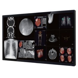 Optik View SC6581 65" 4K UHD Surgical LCD Monitor