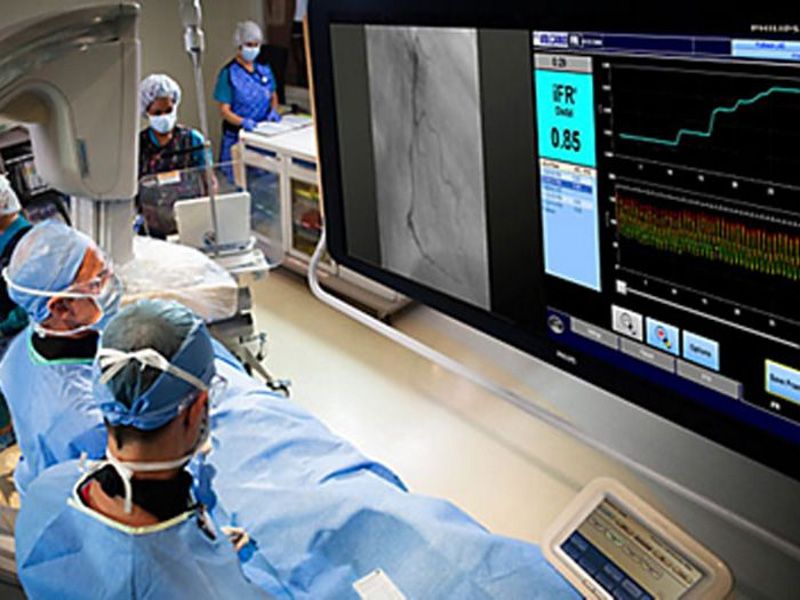 Philips Flexvision CV56SL Cath/Angio Monitor