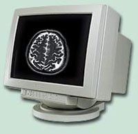 21 Inch Philips 9919 310 13621 Monitor