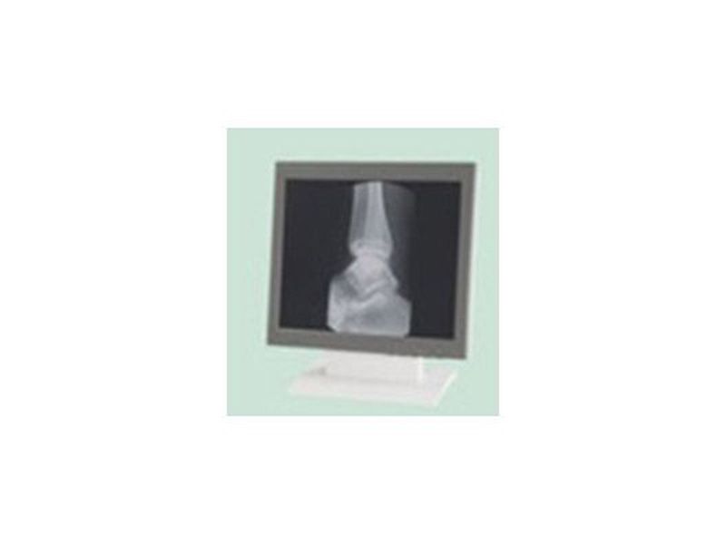 Philips 9919 320 50616 LCD Monitor