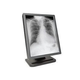 Planar E3 3MP Diagnostic Radiology Monitor