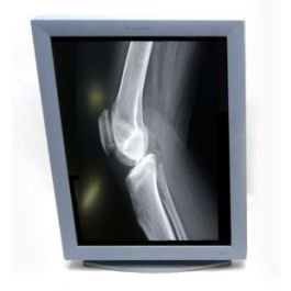 Planar Dome C3i Gray 3MP Diagnostic Radiology Monitor