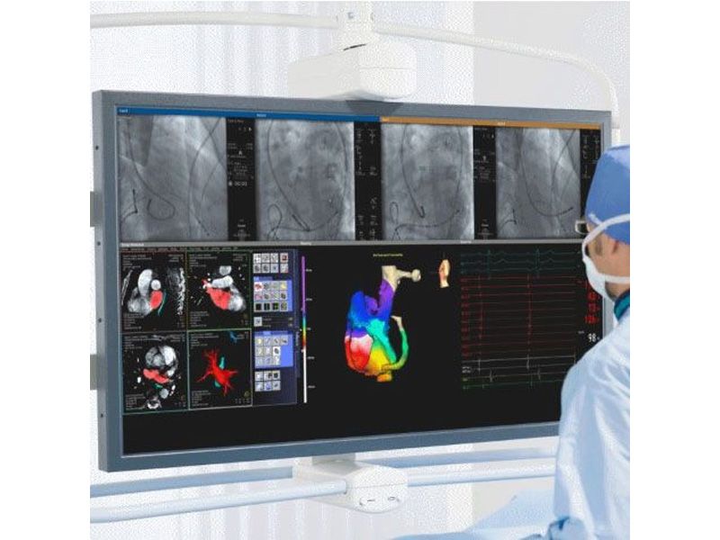 Siemens DSC5515-DC 55" 4K UHD Large Cath Lab Surgical LCD Monitor