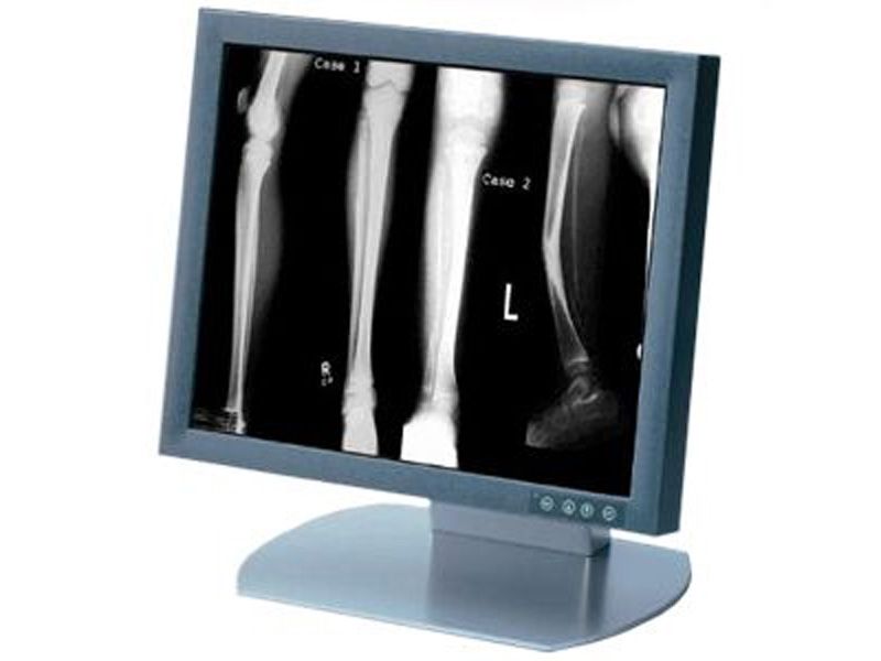 Siemens SMD18101CS 18" LCD Monitor