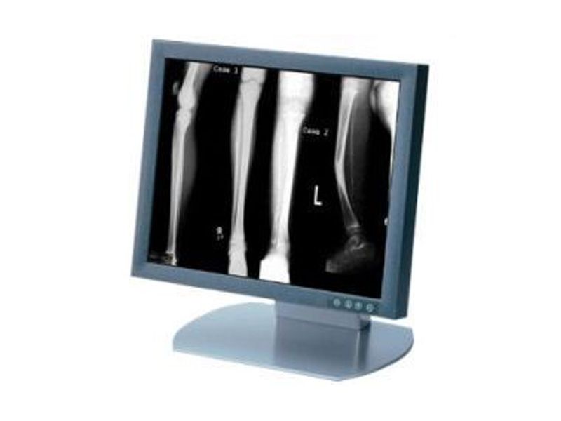 Siemens SMD 18101 G 18" Medical Grade LCD Monitor