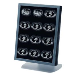 Siemens SMD 21302 D LCD Monitor