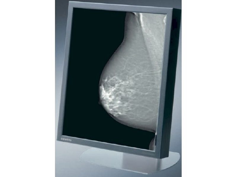 Siemens SMD 21500 G 5MP Diagnostic Radiology Monitor