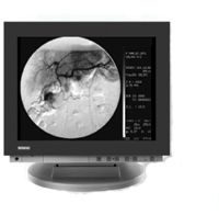 17 Inch Siemens SMM1792L Monitor