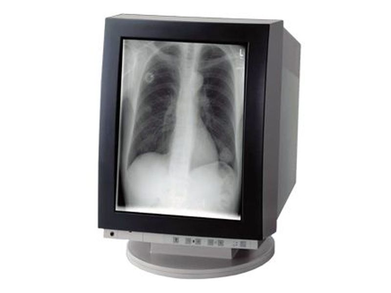 Siemens SMM 21126 P 21" CRT Monitor