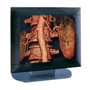 Siemens SXD-1899 LCD Panel