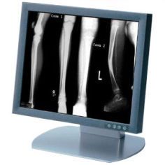 Siemens SMD18101GM (SMD 18101 GM) LCD Display