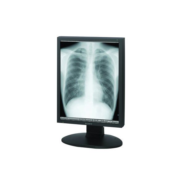 Sony LMD-DM20 2MP Diagnostic Radiology Monitor