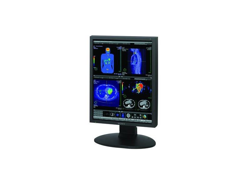 Sony LMD-DM20C 2MP Diagnostic Radiology Monitor