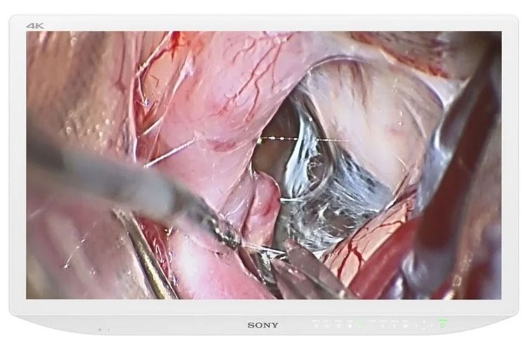 Sony LMD-X3200MD 32" 4K UHD 2D Surgical Display Monitor