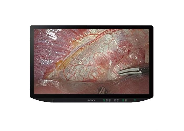 Sony LMD-XH320MT 32