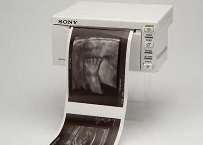 Sony UP-D711MD A7 Digital Black and White Thermal Printer