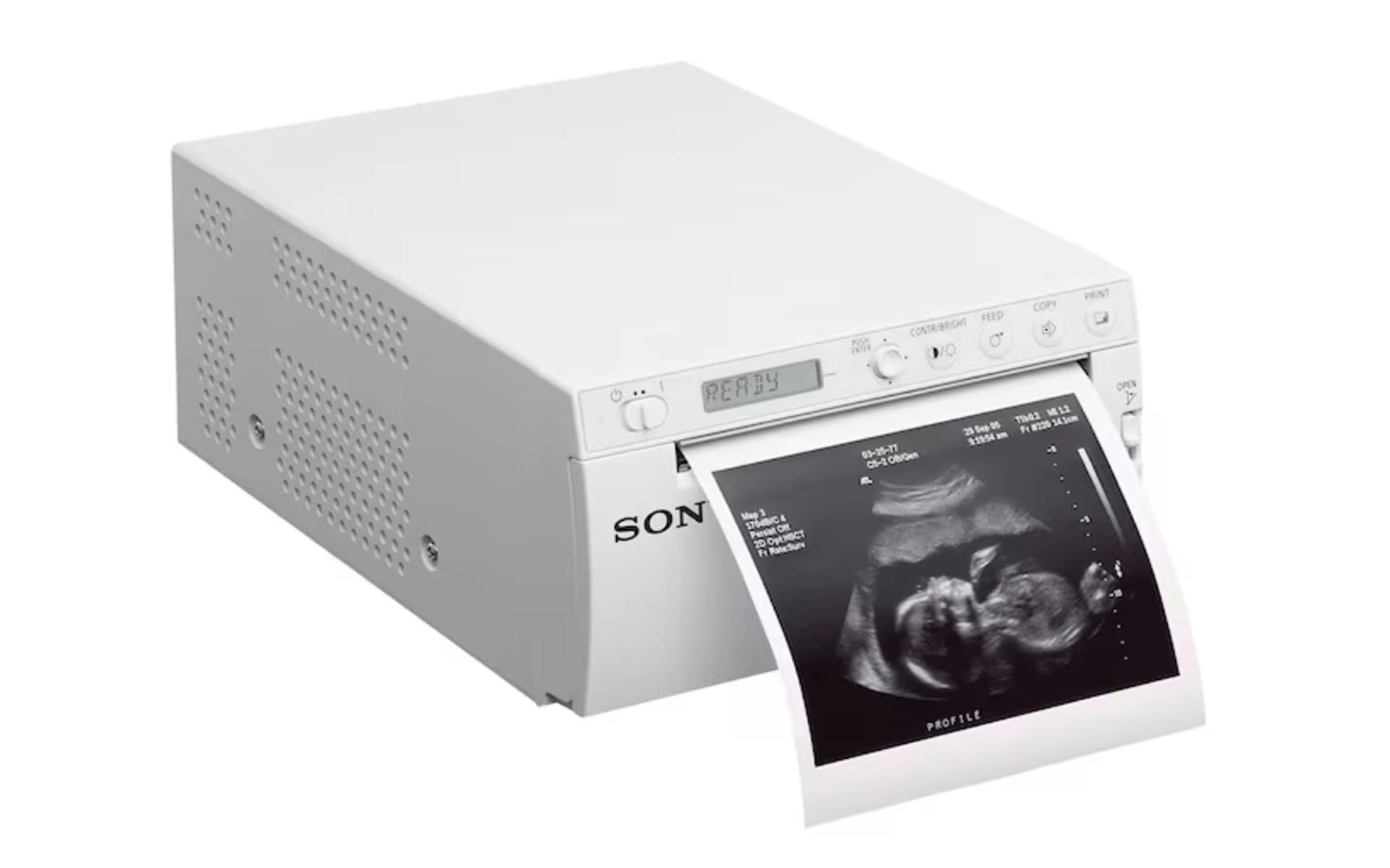 Sony UP-X899MD / UPX899MD A6 Analog/Digital B/W Hybrid Medical Printer