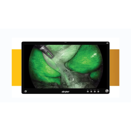Stryker 32" 4K OLED Surgical LCD Monitor – Model 240031300 / 240-031-300
