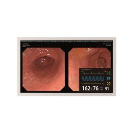 Totoku CCL220 21.5" FHD Surgical LCD Monitor