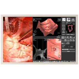 Totoku CCL244 24" WUXGA Surgical LCD Monitor
