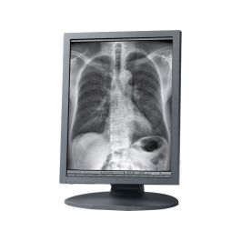 Totoku ME205 20" 2MP Monochrome Diagnostic Monitor