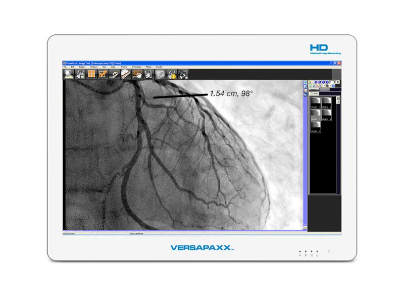 VersaPaxx VP222AV Display Monitor